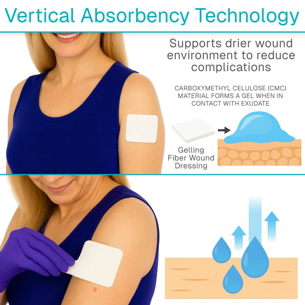 Gelling Fiber Wound Dressing