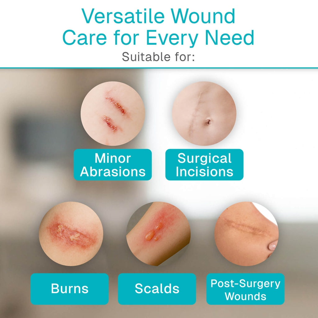 Gelling Fiber Wound Dressing